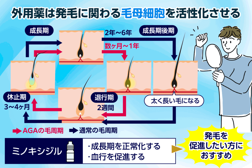 外用薬は発毛に関わる毛母細胞を活性化させることを示したフローチャート画像