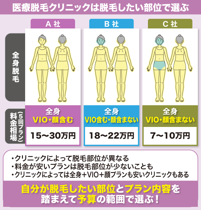 医療脱毛クリニックの施術部位と料金相場の図解