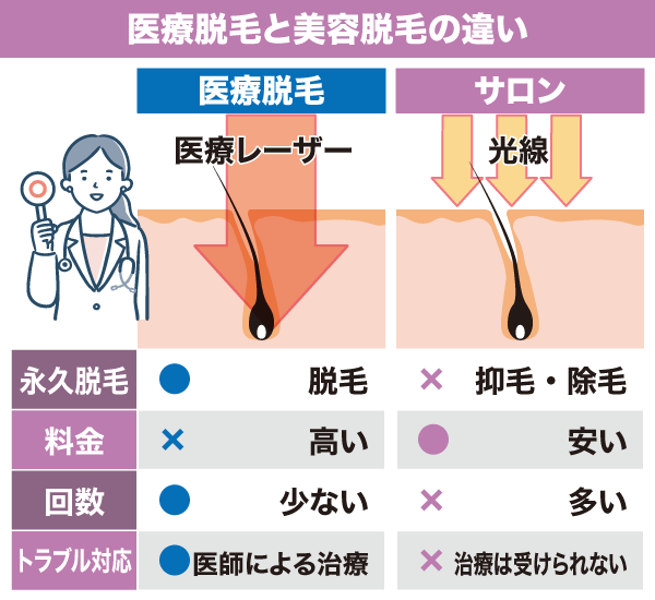 医療脱毛と美容脱毛の違いをまとめた図解